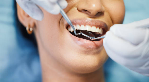 Best Broken or Chipped Tooth Repair in Spring Ridge, MD