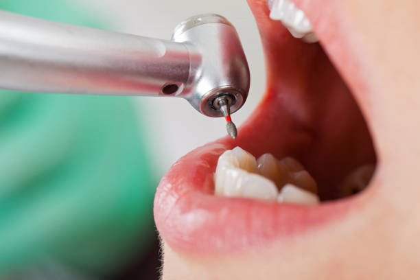 Best Emergency Dental Care for Sports Injuries in Spring Ridge, MD